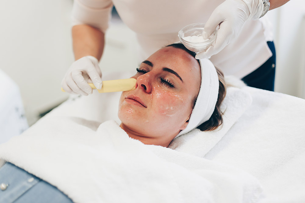 Behandlung von Gesichtsrötungen mit Laser, Rötungen im Gesicht, was hilft dagegen, Behandlung Kosmetikstudio, Laserbehandlung Gesicht, Beauty Blog, Erfahrungsbericht, Vorher Nachher Bilder, www.whoismocca.me