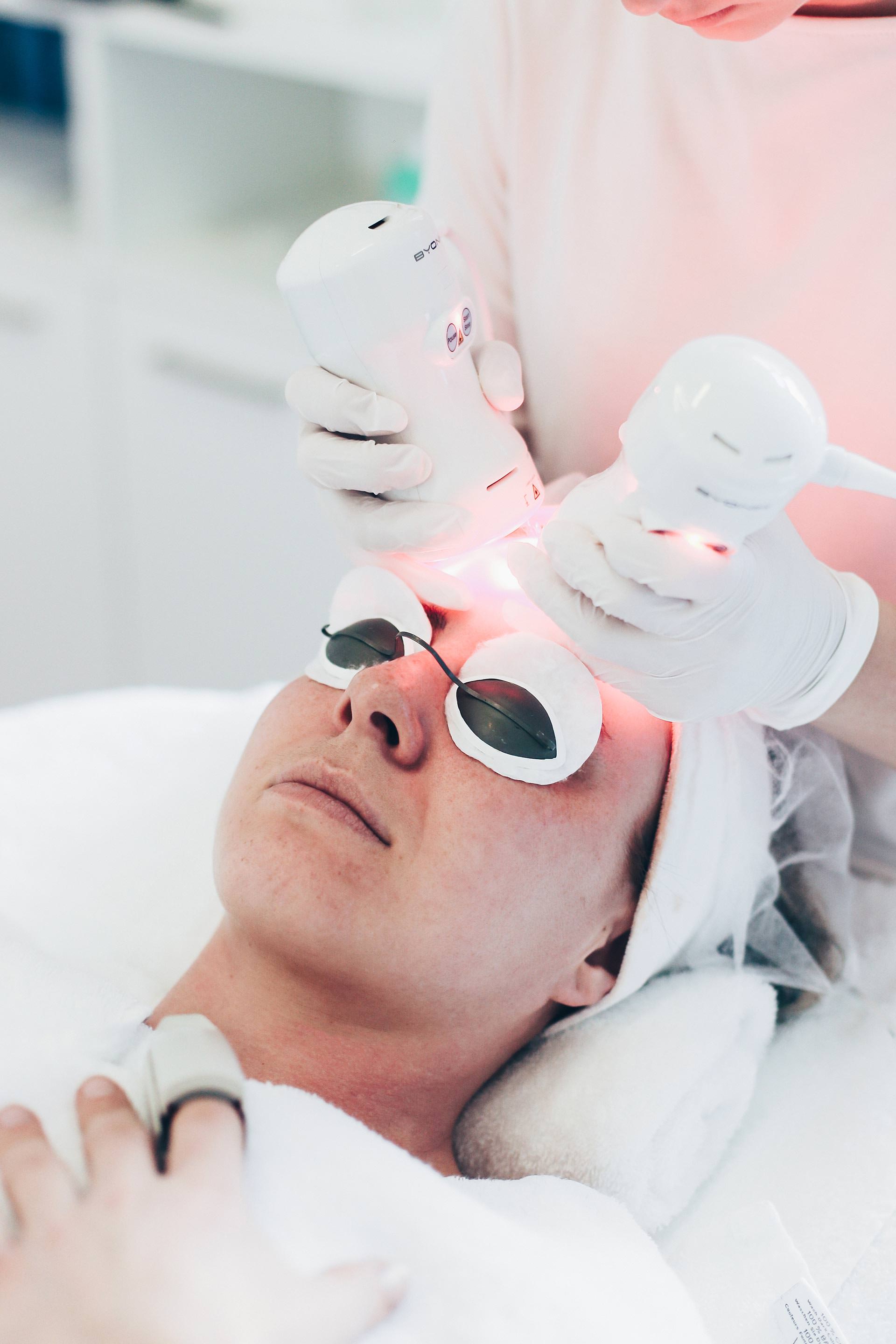 Microdermabrasion und Laserbehandlung für feinporige straffe Haut, Gesichtsstraffung ohne OP, Microdermabrasion Erfahrungen Innsbruck, Beauty Report, Erfahrungsbericht, Beauty Blog, www.whoismocca.me